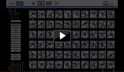 White blood cell differentiation automation